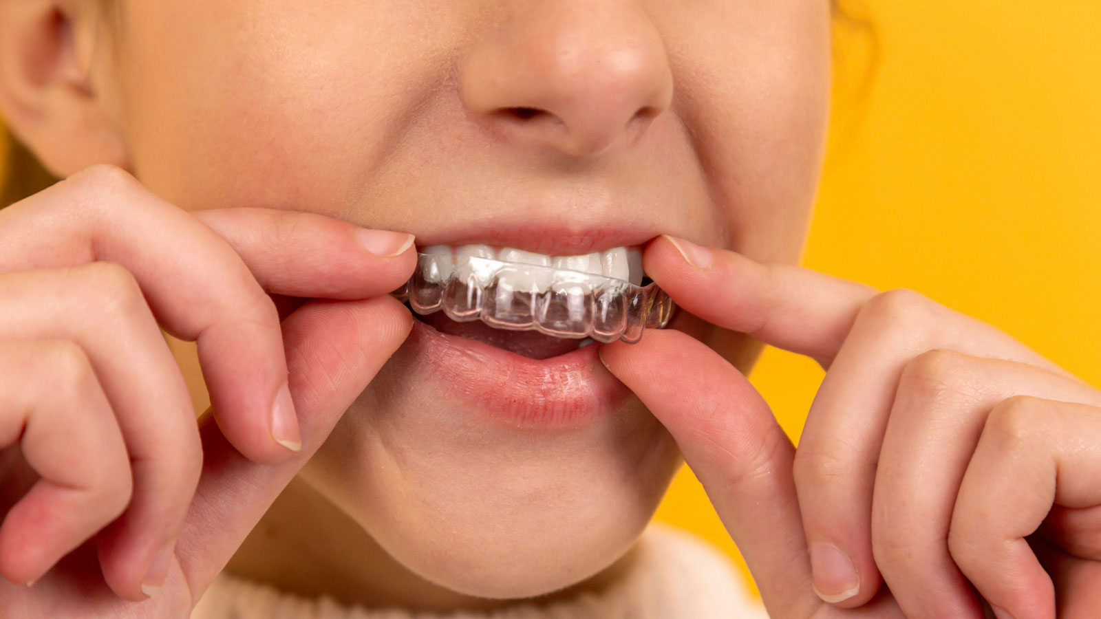 girl-putting-retainer-inside-her-mouth