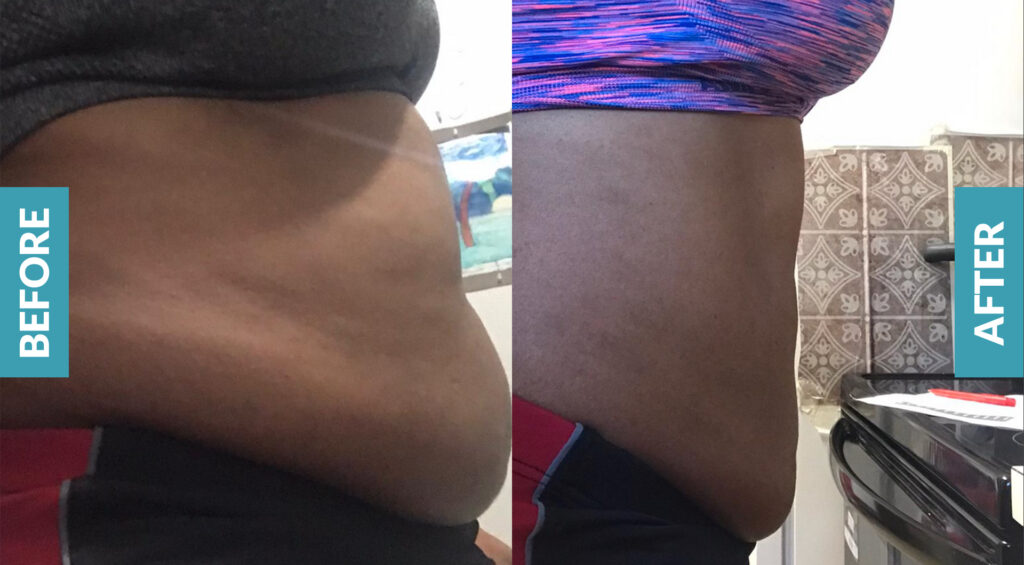 Isavera Before and After