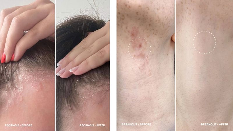magic molecule before and after