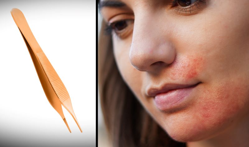 plucking hair side effects