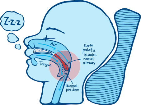 how airsnore works